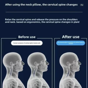 Sde846c874d564f59948fe947d65fcf9ag.webp Orthopedic Cervical Pillow – Memory Foam Neck Support Pillow for Spine Alignment, Anti-Hunchback & Comfortable Sleep