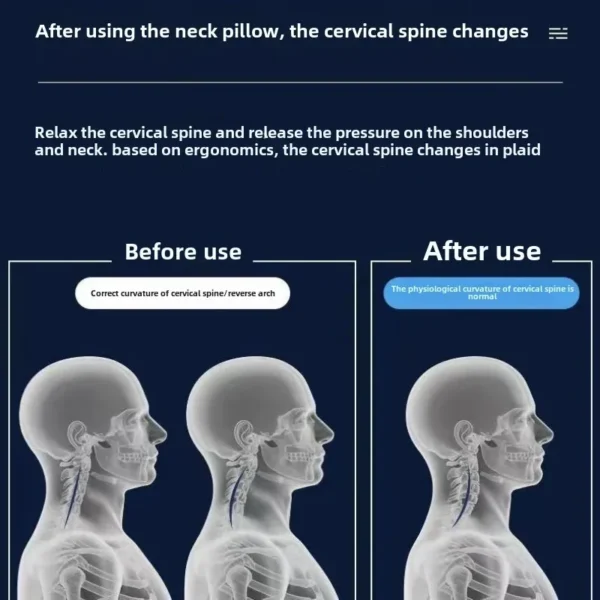 Sde846c874d564f59948fe947d65fcf9ag.webp Orthopedic Cervical Pillow – Memory Foam Neck Support Pillow for Spine Alignment, Anti-Hunchback & Comfortable Sleep